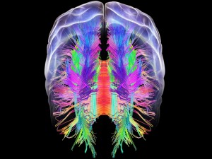 brain-image-by-general-physics-lab-creative-commons